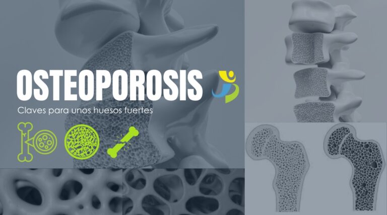 OSTEOPOROSIS, CLAVES PARA UNOS HUESOS FUERTES
