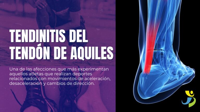 TENDINITIS DEL TENDÓN DE AQUILES